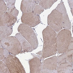 CRBN Antibody, Novus Biologicals 0.1mL; Unlabeled:Antibodies, Polyclonal